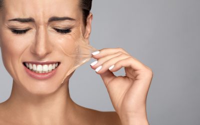 Ragyogás és megújulás – Miért bízza bőrgyógyászra a kémiai hámlasztást?